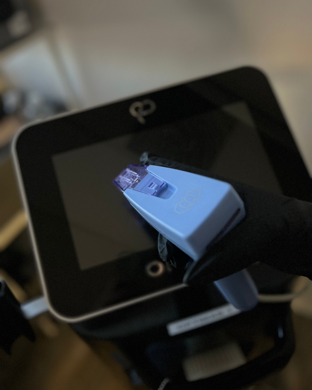 Morpheus8 Body Treatment in Denver: Expert Insights on Skin Tightening &amp; Body Remodeling