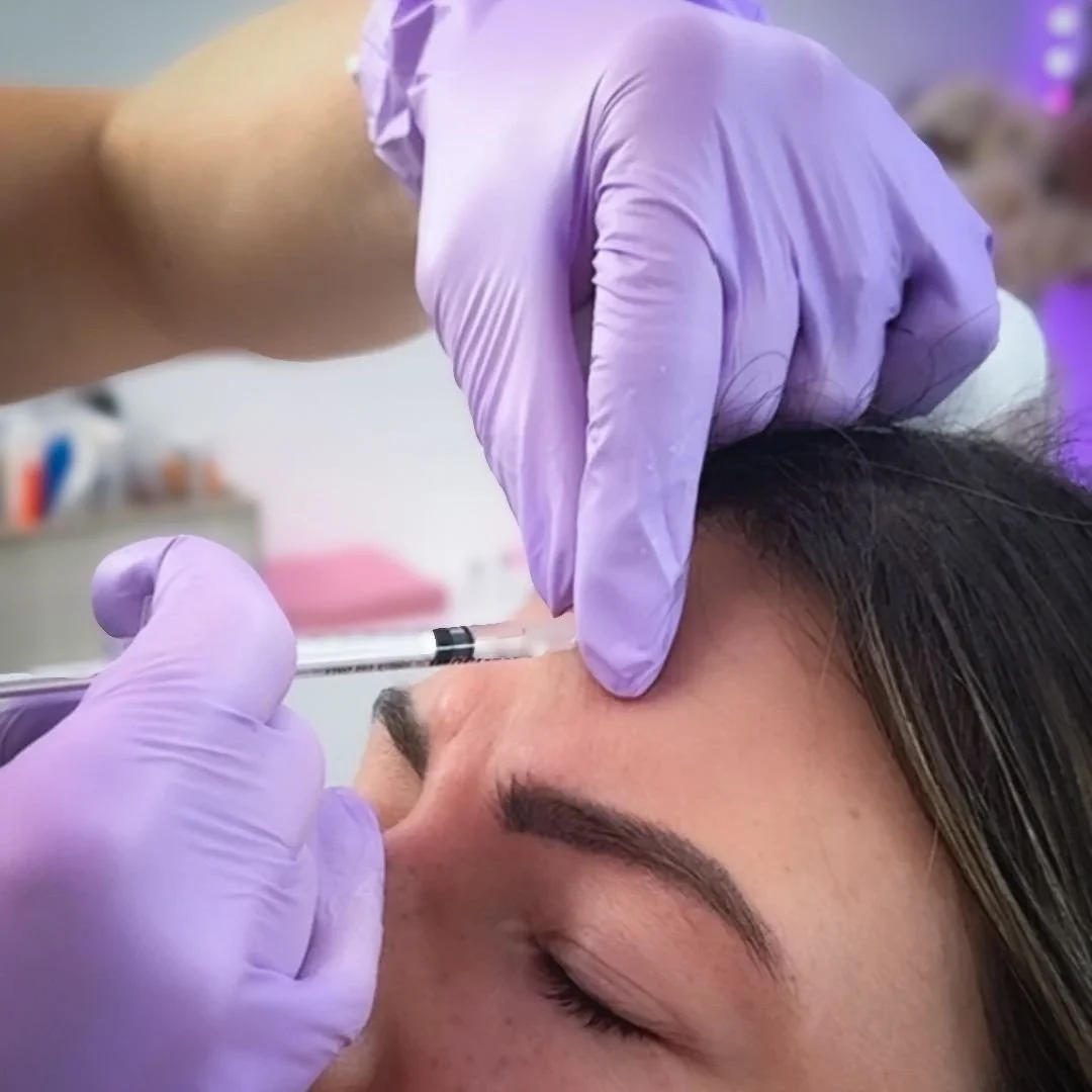 botox-injection-forehead-rachaels-med-spa-ellicottville.webp.jpg