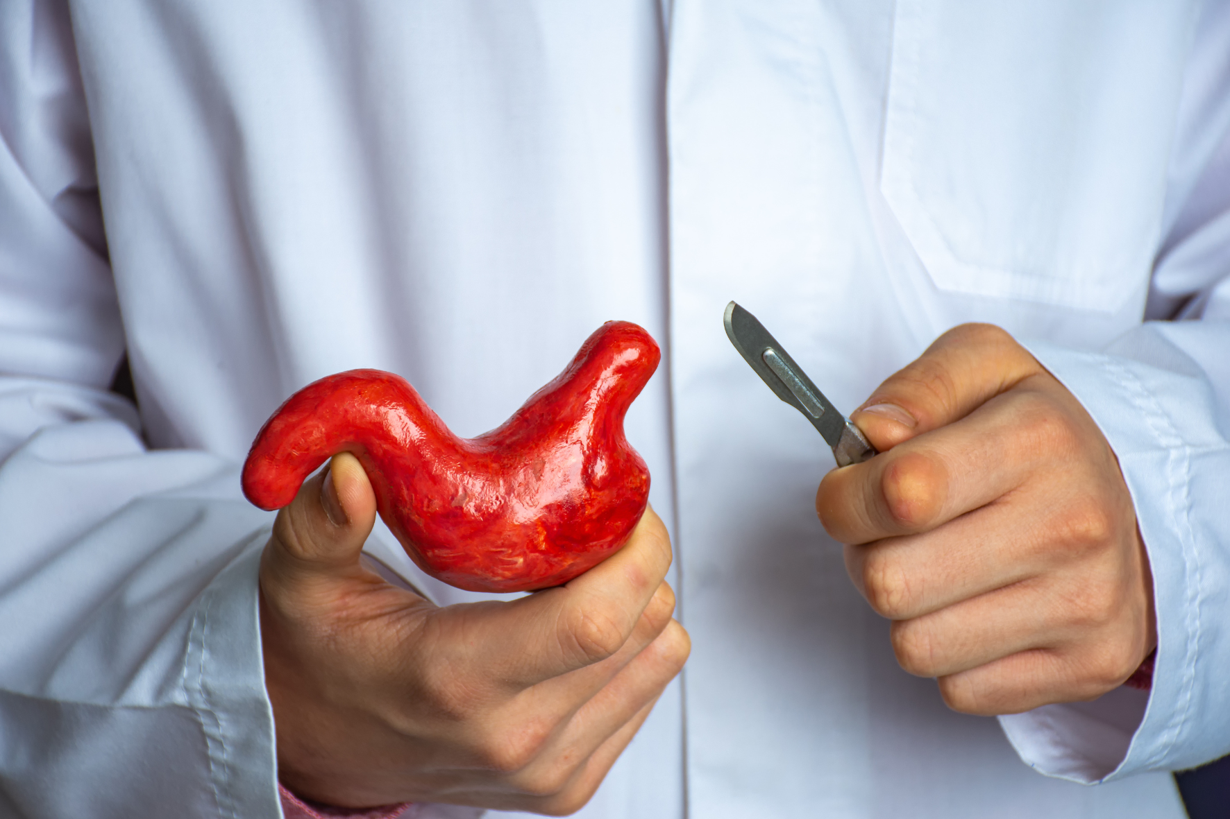 Life After Bariatric Surgery: Preventing Weight Regain and Ensuring Long-Term Success