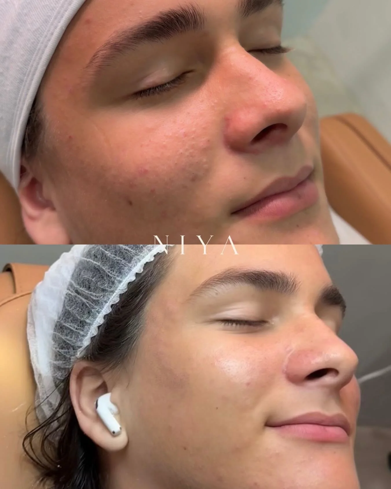 The reset your skin needed. ✨

Cleaner, brighter, and refreshed.

And the best results come with consistency. Ask us about our memberships for exclusive savings on your monthly skin maintenance.

Book your facial at NIYA.&nbsp;

#NIYAMiami #facialbef