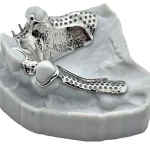 Frame Only with Model - 3D printed with Chromium Cobalt (amazing fit)