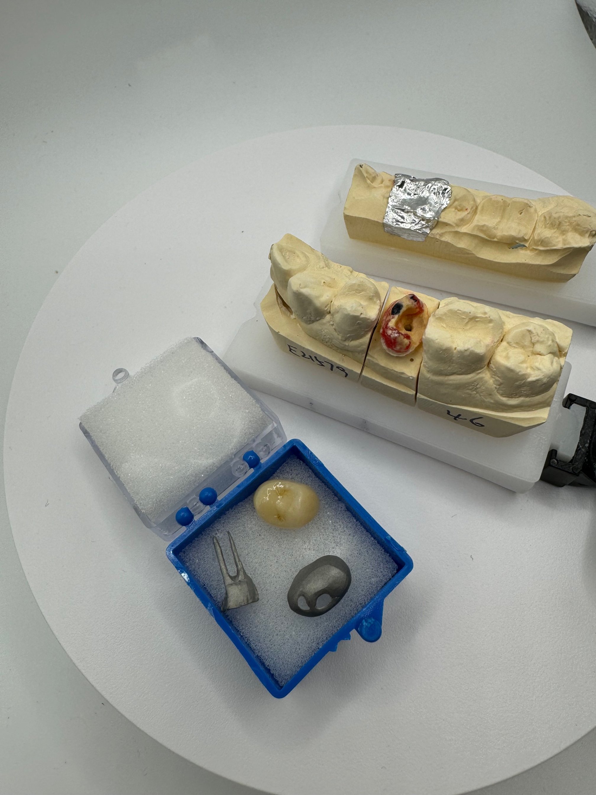 Zirconia Crown - Reduction Copings and Post Core Fabrication
