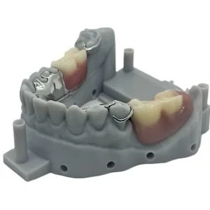 Frame to Finish with Model Teeth in Lucitone