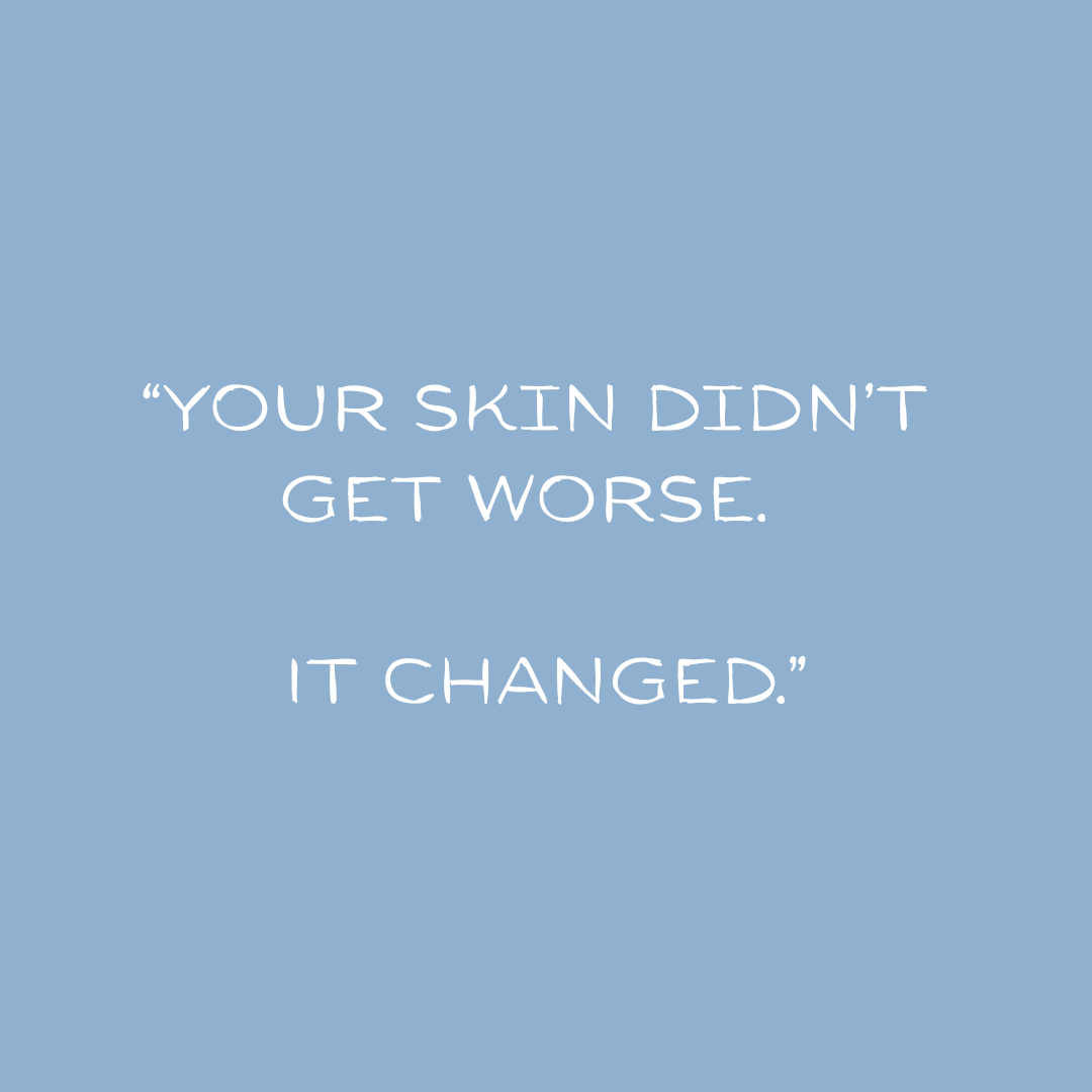 Your skin isn't worse, it just changed