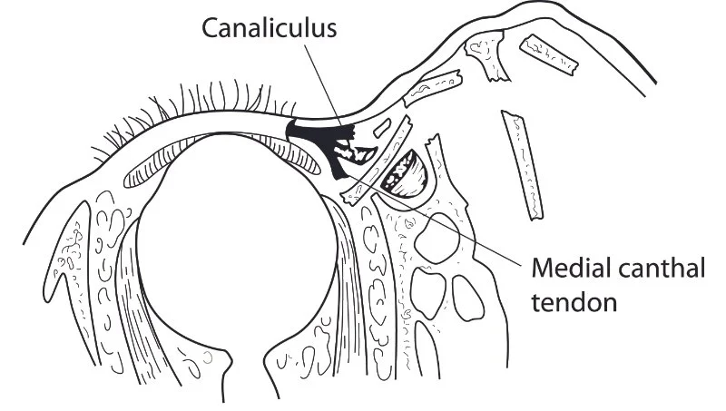 cranio 01 800dpi.jpg