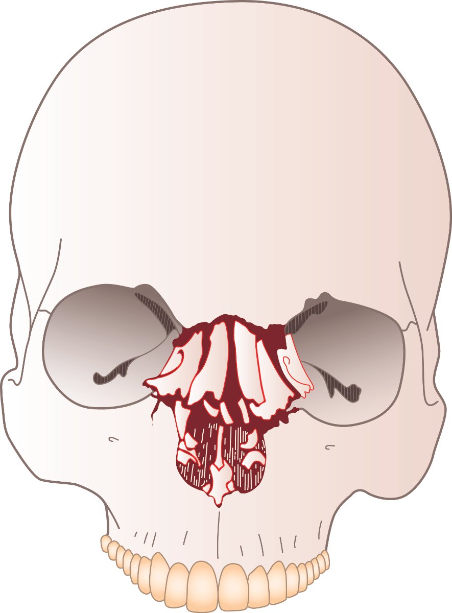 cranio 02 1200dpi.jpg