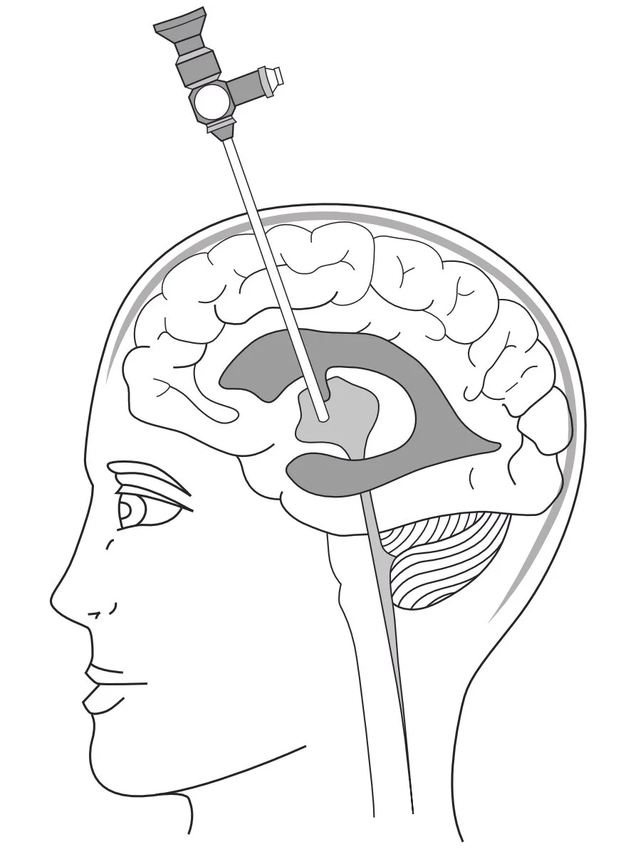 Endoscope 1200dpi.jpg
