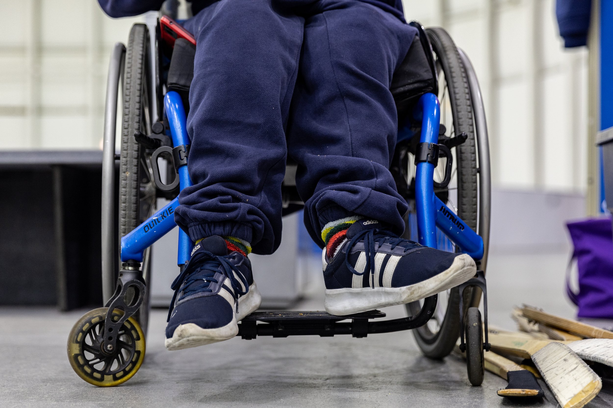 Myles was born with spina bifida, a congenital birth defect that occurs when the spine doesn’t close properly during fetal development. As a result, Myles deals with partial paralysis and hydrocephalus as a result of the damaged neural pathways and a