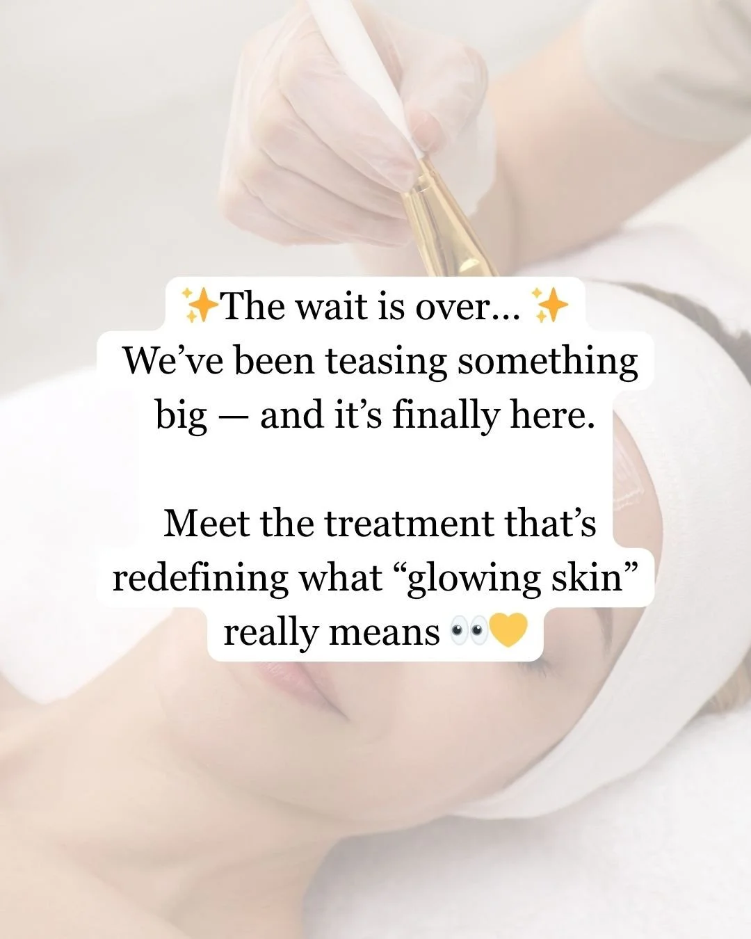 ✨ The secret&rsquo;s out&hellip; and we&rsquo;re so excited to finally share it! ✨⁠
⁠
For a while we&rsquo;ve been hinting at something new &mdash; and it&rsquo;s finally here. Meet VI Peels, the #1 medical-grade treatment for brighter, smoother, and