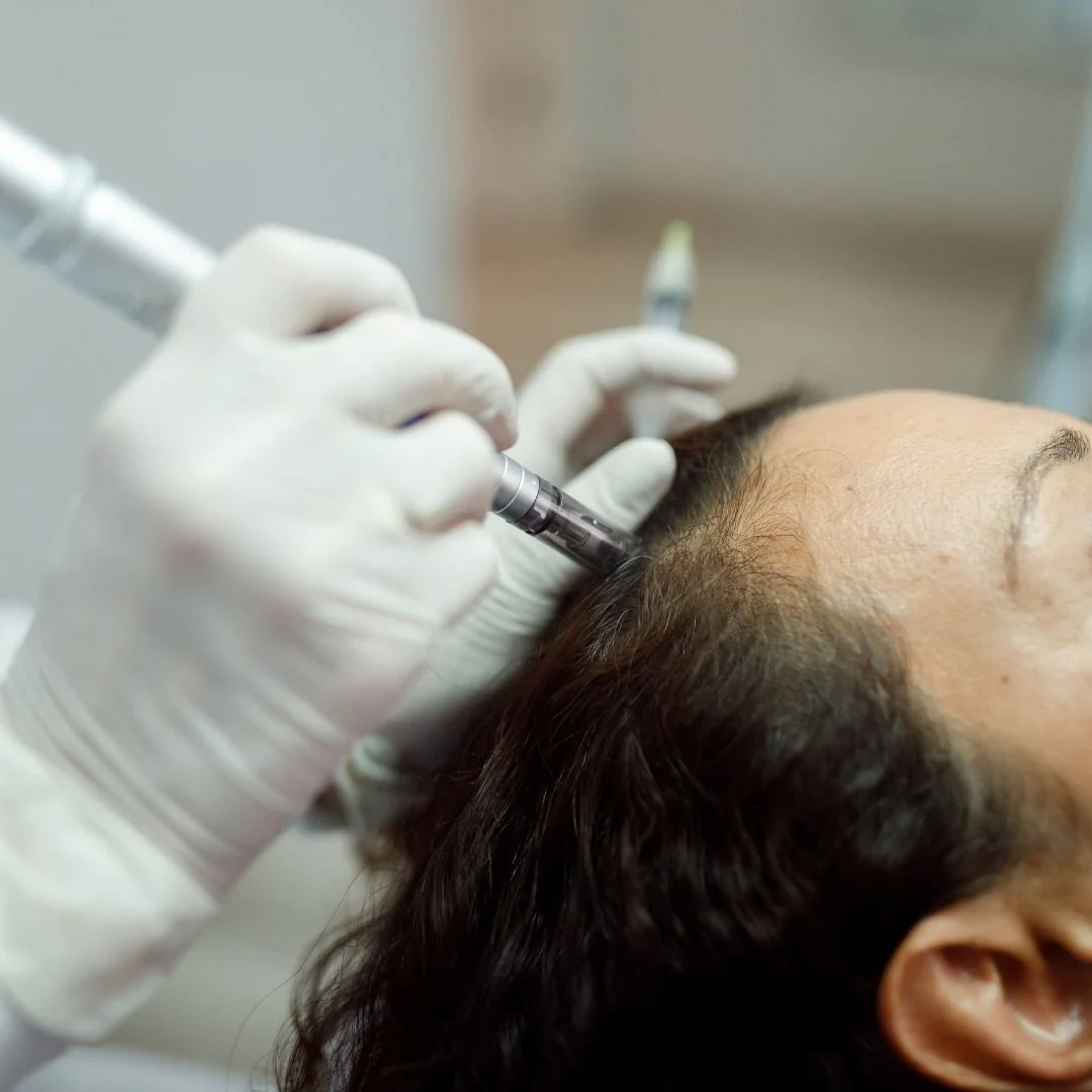 What if you could stimulate your hair follicles to grow thicker, healthier hair without resorting to surgery?

De|Rive Hair Restoration makes that possible!

Using the Collagen P.I.N. microneedling device, we create tiny channels into your scalp that