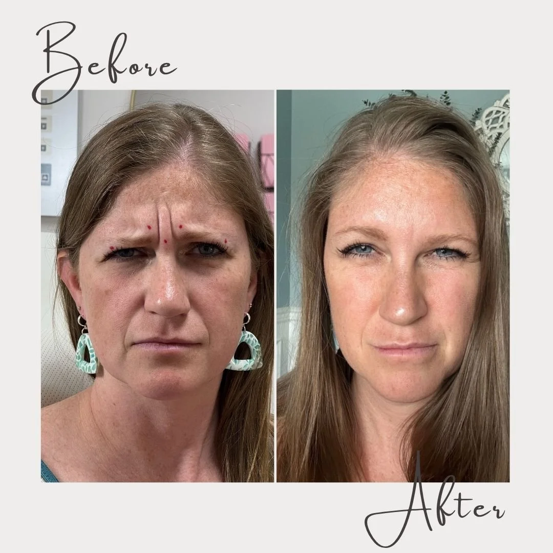 One of the things clients love most about tox treatments is how subtle the results can be ✨

Softer lines, a more rested look, and facial movement that still feels like you. The goal is never frozen or overdone. It&rsquo;s looking refreshed, confiden