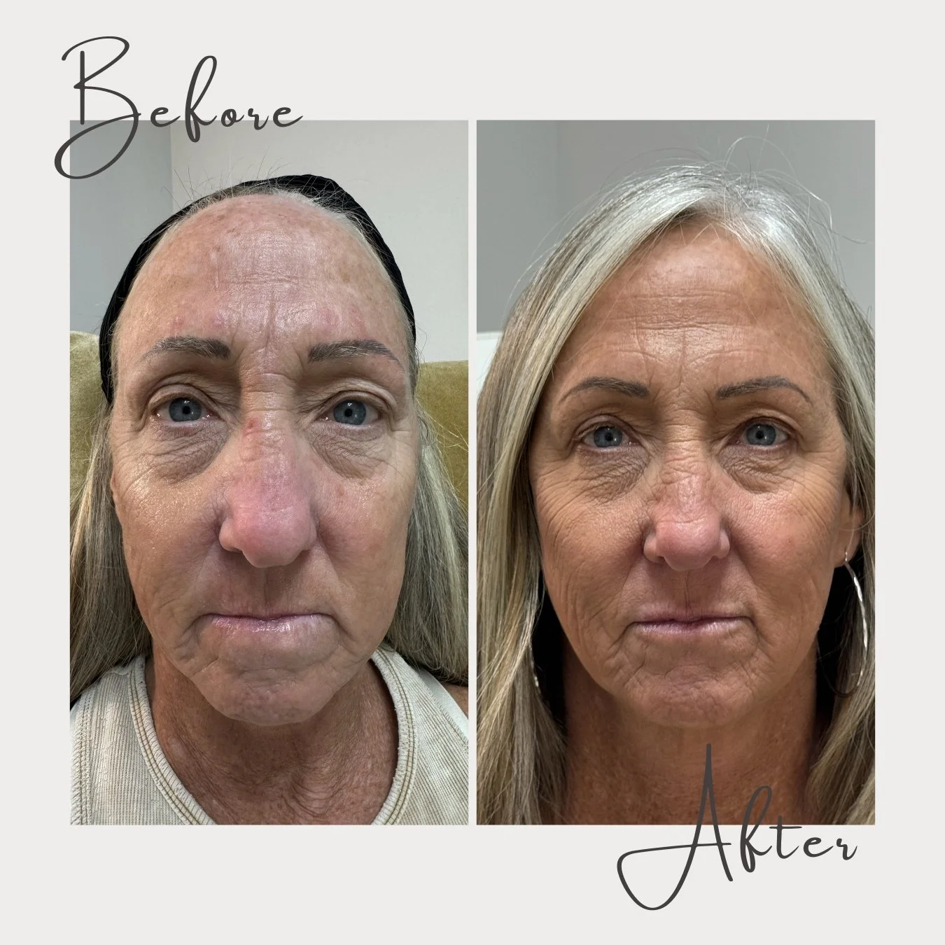 Imagine stepping out each day with the confidence that comes from looking as young and vibrant as you feel inside. ✨

We're so excited to share the journey of one of our incredible clients, who&rsquo;s been with us working on an Individual Care Plan 