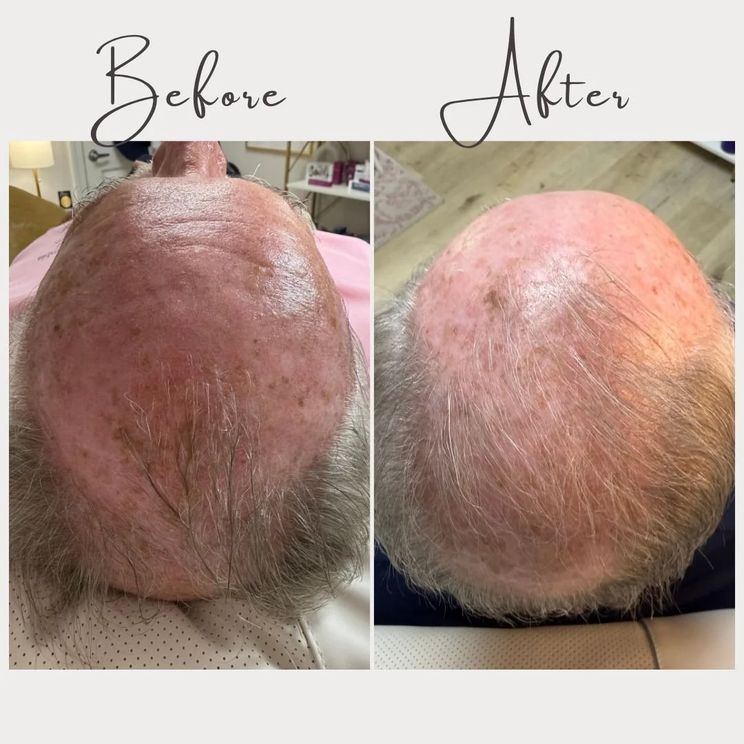 Yesterday we shared that De|Rive is getting national recognition with a feature on Fox News&hellip; and it&rsquo;s airing TONIGHT at 5pm ✨

But we couldn&rsquo;t let today go by without showing you what we&rsquo;re seeing right here in our own practi