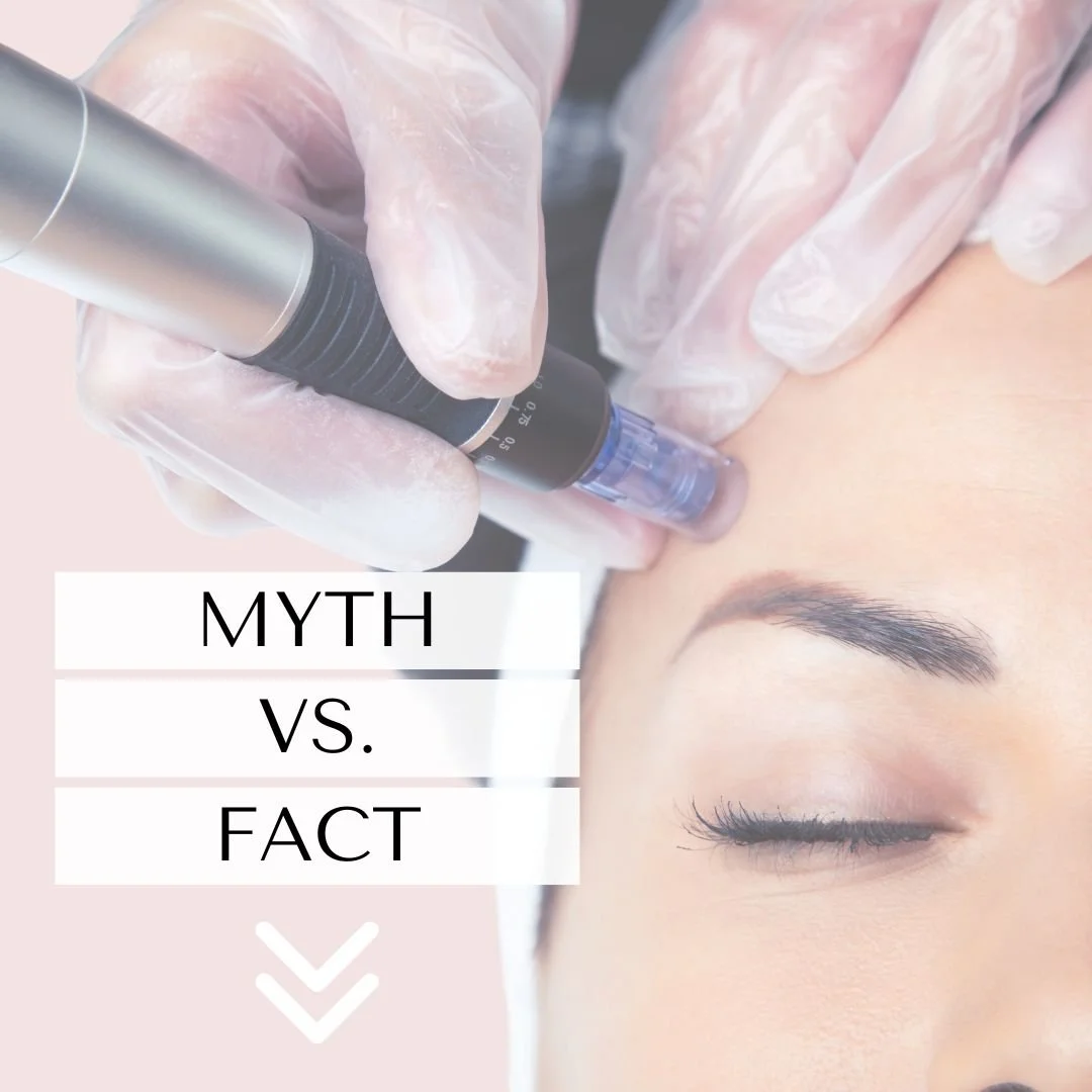 Myth: "Microneedling hurts!" ❌

Fact: This is a common concern, but we&rsquo;re happy to say that with modern technology and expert care, microneedling is virtually pain-free. ✨

At Elevate, we apply a numbing agent before your treatment, s