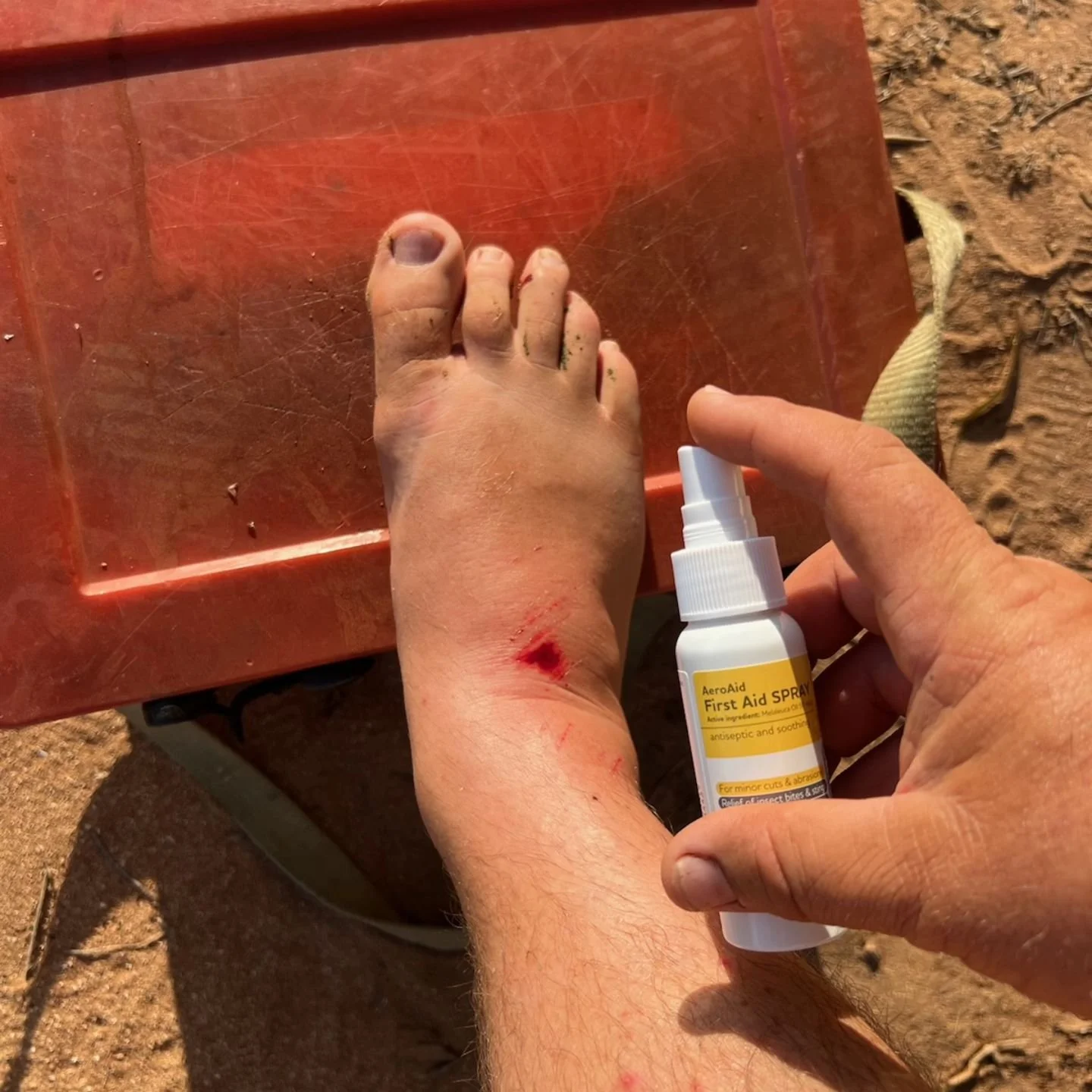 When you're 5 minutes into a fishing trip, and you actually take your first aid kit with you...... winning! 

#camping #firstaidkit #survivalfirstaid #essentialtrainingoz #firataidspray #fishing #porthedland #pilbaratraining #pilbarakits