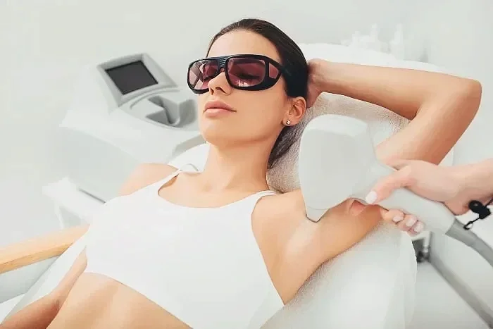 Triệt lông nách bằng Diode Laser làm lạnh tại Hugo Beauty Phú Nhuận, TP.HCM