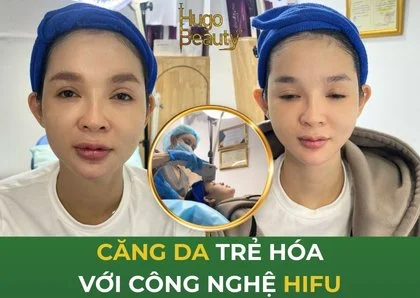 Công nghệ căng da HIFU – Giải pháp trẻ hóa da không xâm lấn tại TP.HCM