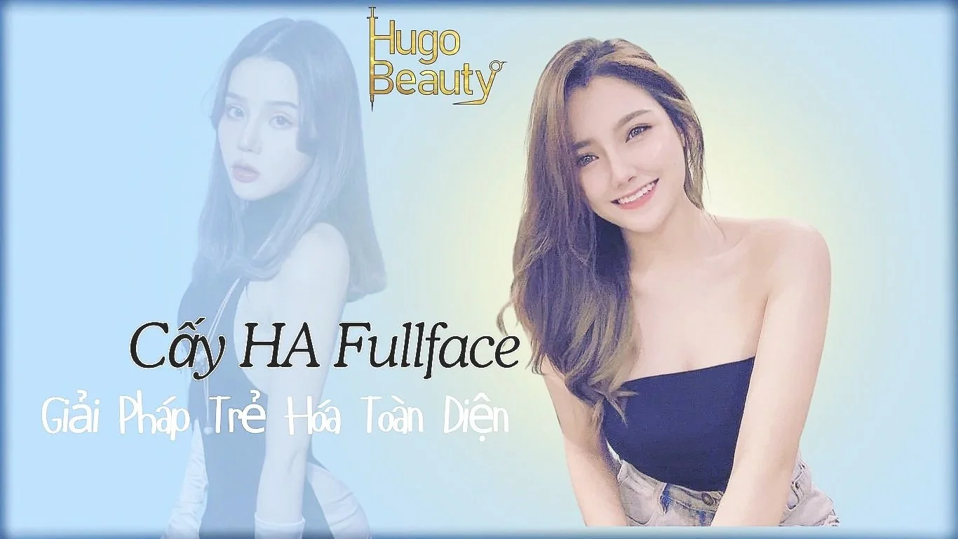 Tiêm Cấy HA Fullface: Giải Pháp Trẻ Hóa Toàn Diện