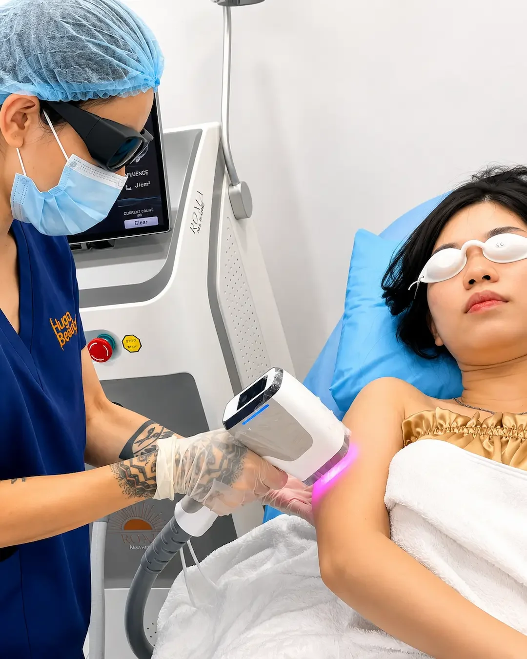 Triệt lông tay chân bằng công nghệ Diode Laser tại Hugo Beauty Phú Nhuận TP.HCM