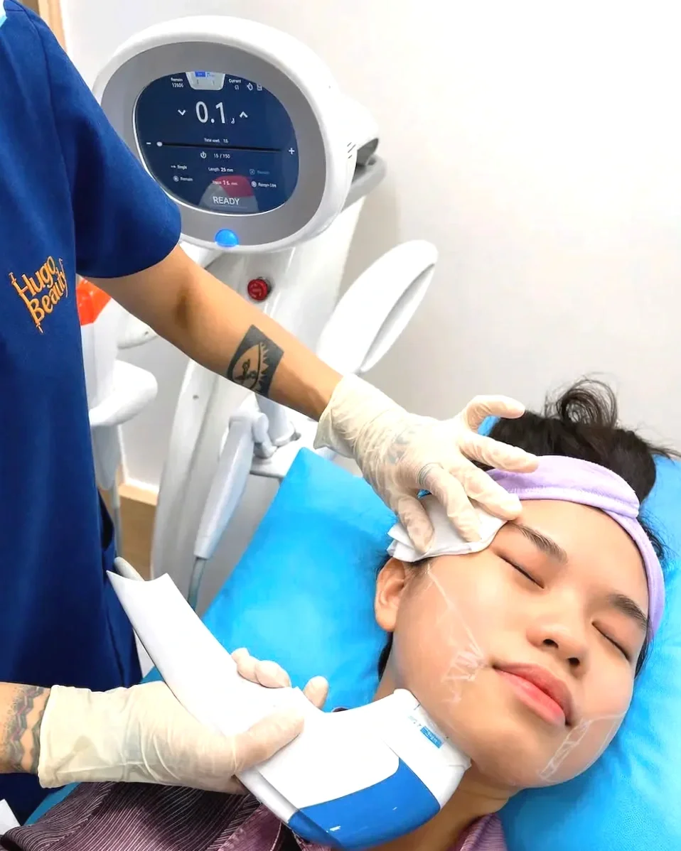HIFU Ultraformer MPT face lifting treatment at Hugo Beauty Phu Nhuan