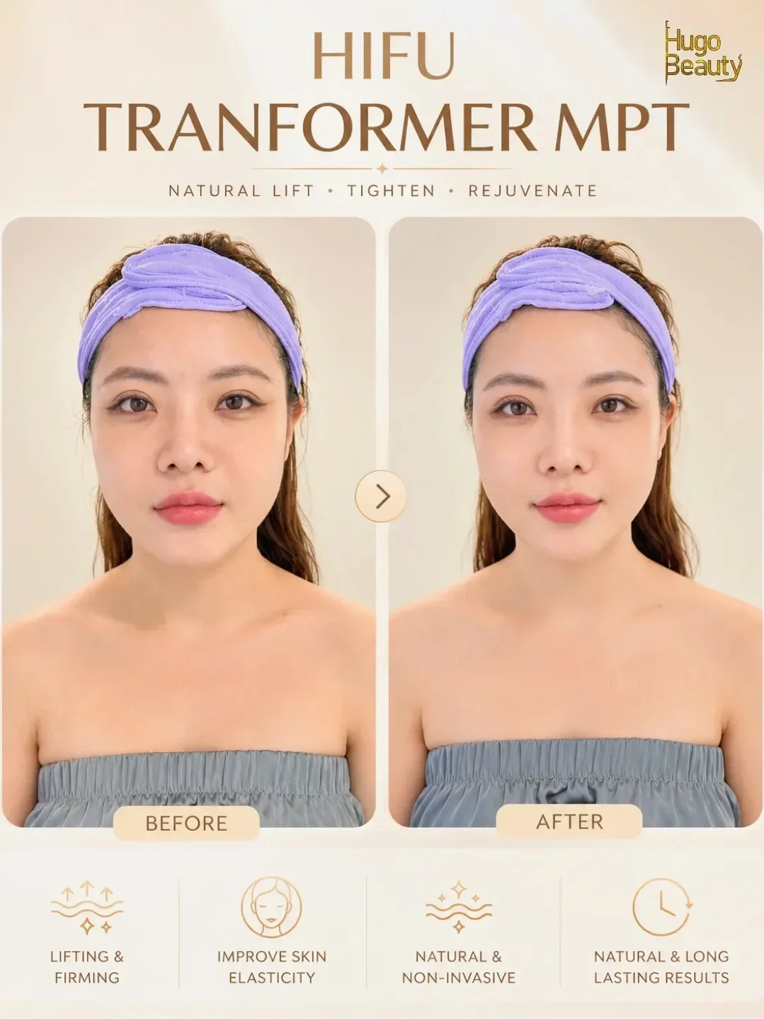 Làm HIFU Có Đau Không? Trải Nghiệm Ultraformer MPT Tại TP.HCM