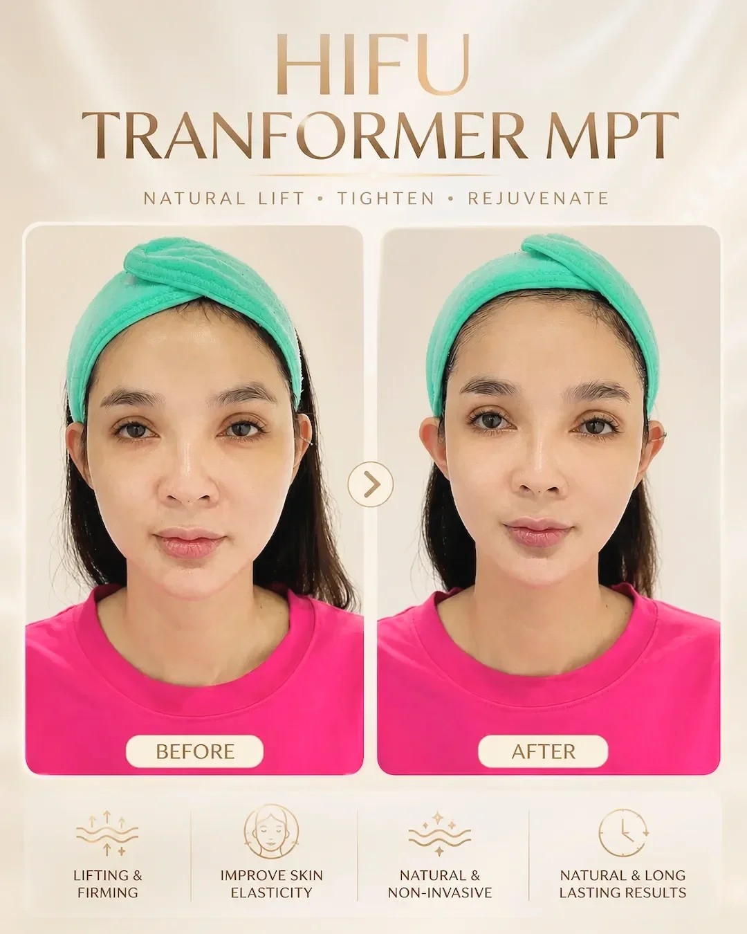 Độ Tuổi Nào Phù Hợp Để Thực Hiện HIFU?