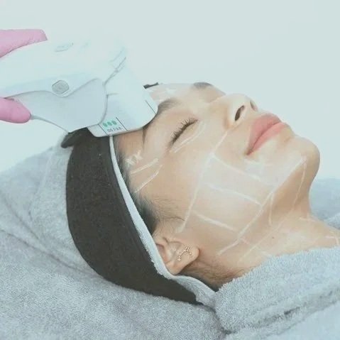 Nâng cơ HIFU 10D – công nghệ trẻ hóa da không xâm lấn, sử dụng sóng siêu âm hội tụ tác động sâu vào lớp SMAS, kích thích tăng sinh collagen và elastin, giúp da săn chắc, căng mịn và ngăn ngừa lão hóa hiệu quả.