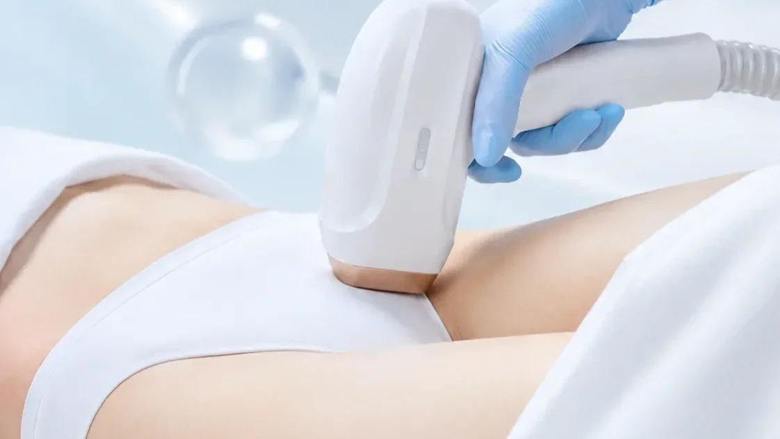 Dịch vụ triệt lông bikini bằng laser công nghệ cao giúp da mịn màng tại Hugo Beauty.