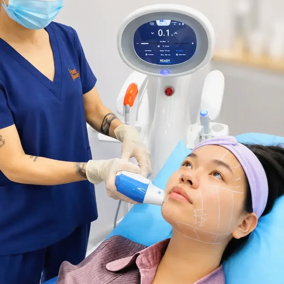 Ultraformer MPT HIFU procedure for a client at Hugo Beauty in Phu Nhuan, Ho Chi Minh City.