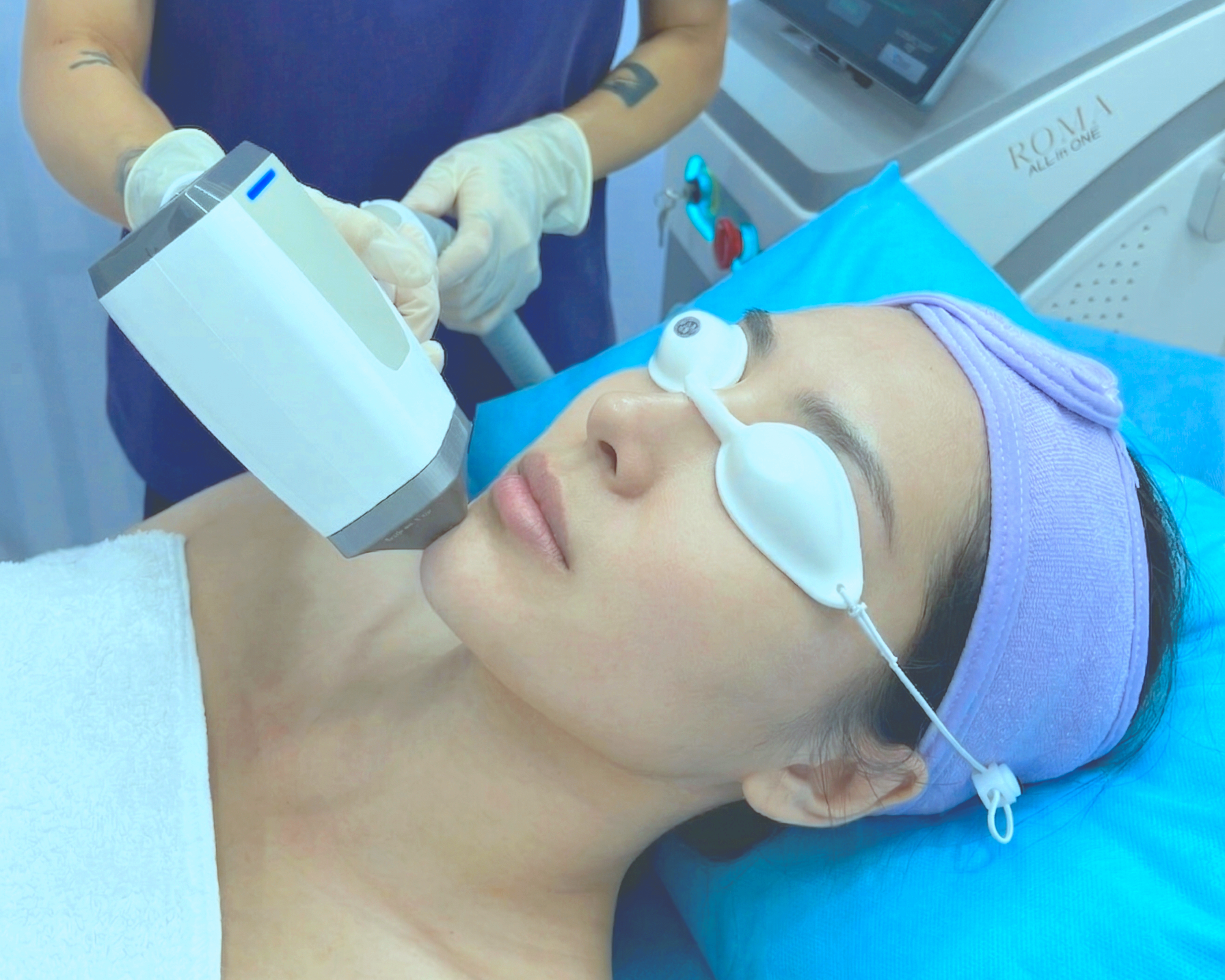 A woman lying on a medical bed with protective eye covers, undergoing a laser skin treatment on her face performed by a medical professional using a handheld laser device in a clinical setting.