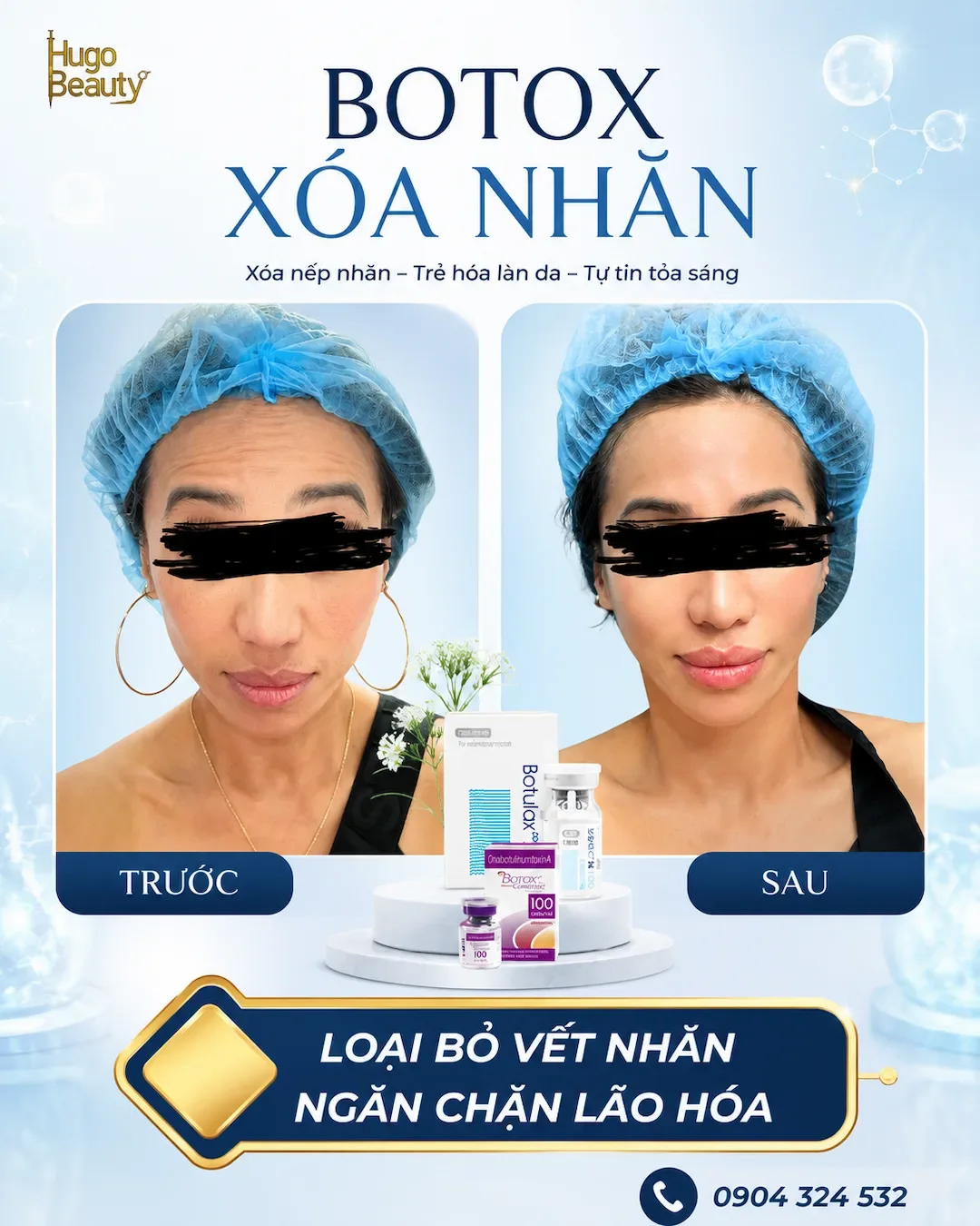 Botox xóa nhăn trước và sau tại Hugo Beauty giúp da mịn màng trẻ trung tự nhiên