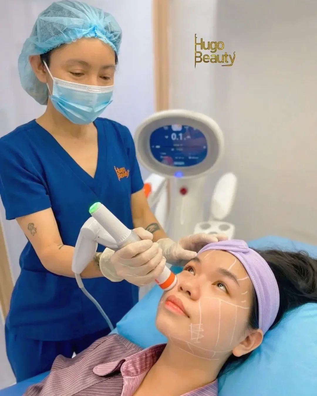 Founder Phạm Thúy Kiều đi máy HIFU Ultraformer MPT nâng cơ và thon gọn jawline viền hàm cho khách hàng tại Hugo Beauty TP.HCM, Việt Nam