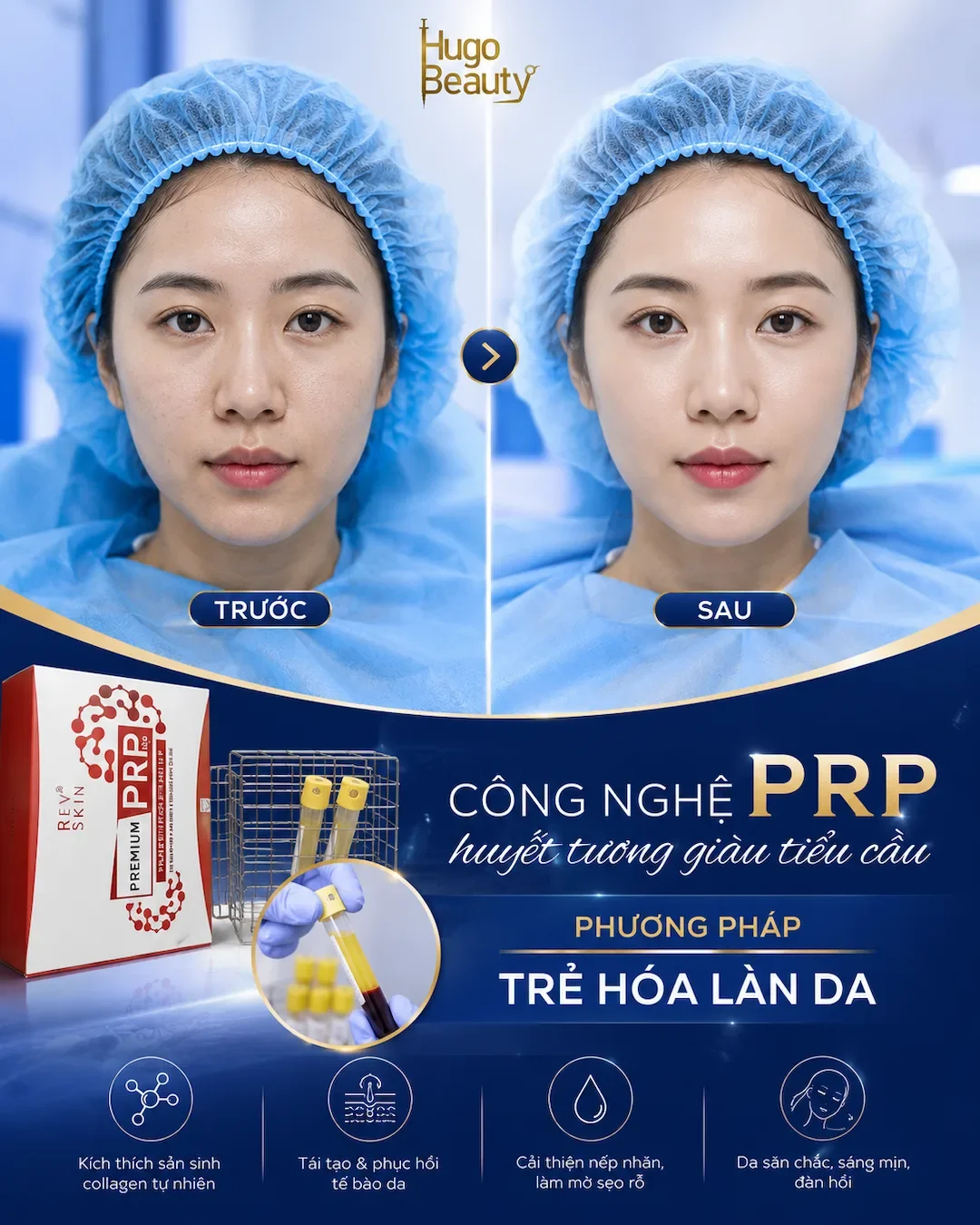 Hình ảnh trước và sau trẻ hóa da PRP tại Hugo Beauty với làn da căng bóng, mịn màng và rạng rỡ tự nhiên