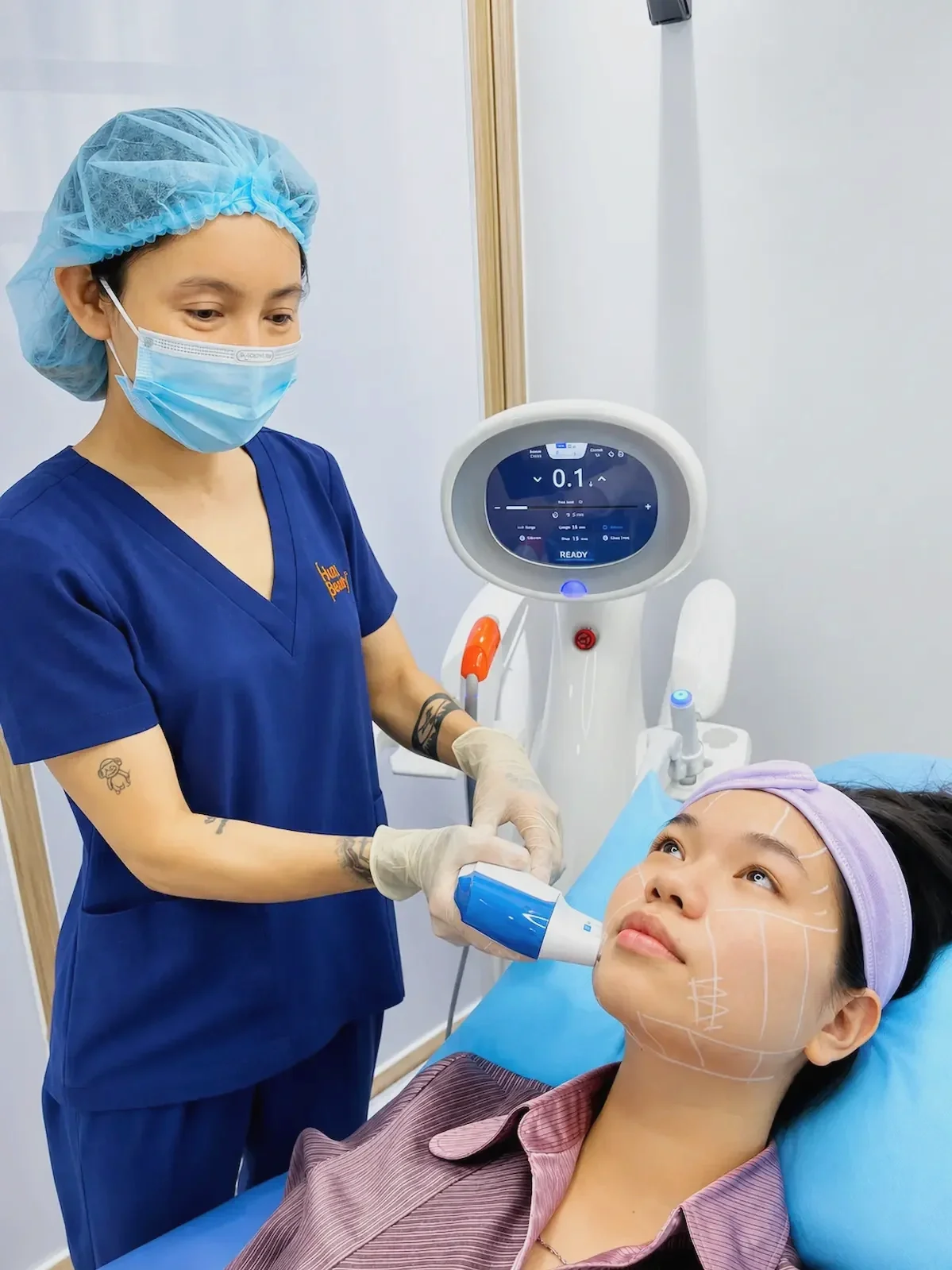 HIFU handpiece placed along white mapping lines on a client's face at Hugo Beauty, Ho Chi Minh City