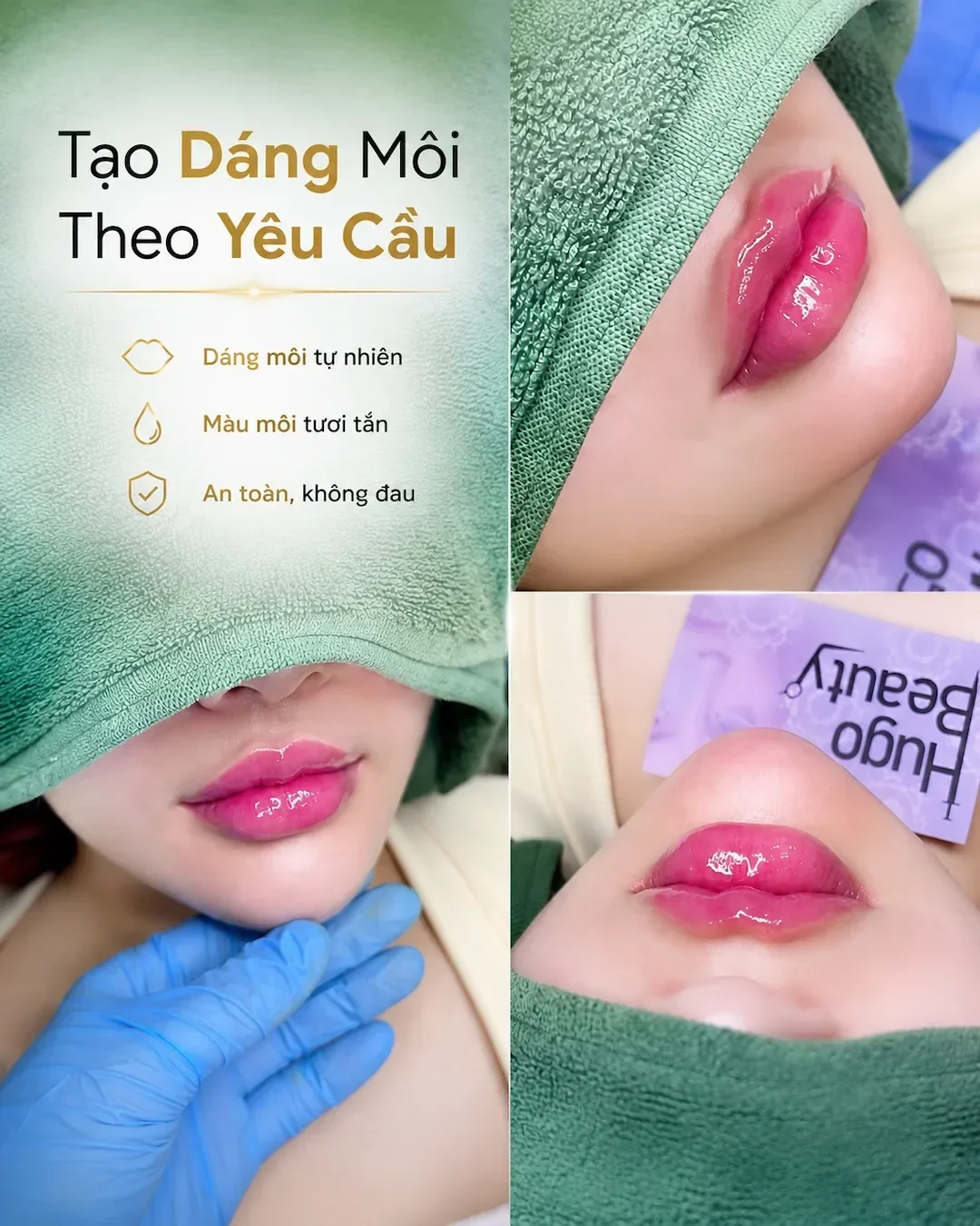Soft, clearly bordered lips in proportion with the face at Hugo Beauty in Phu Nhuan, Ho Chi Minh City