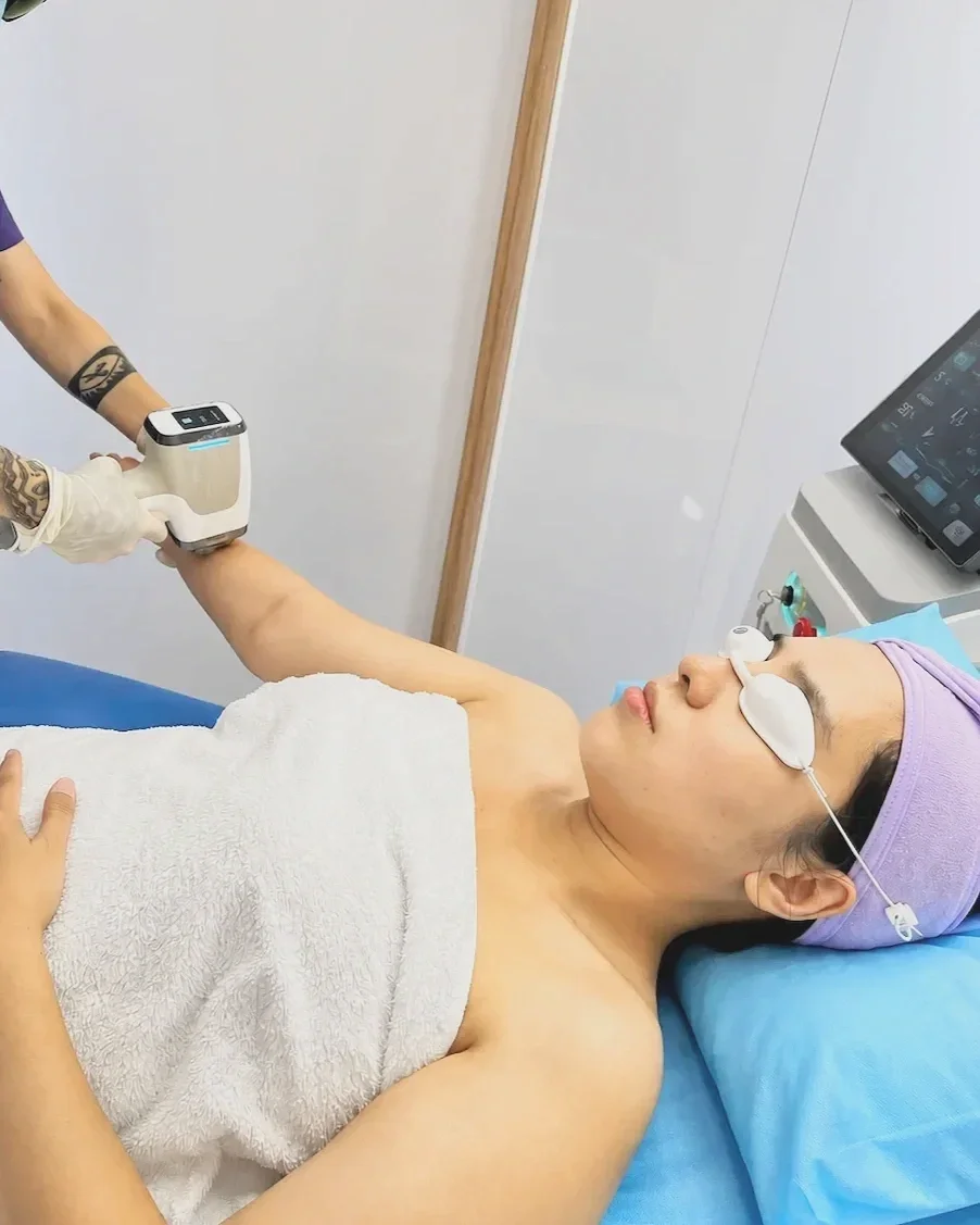 Triệt lông tay chân bằng công nghệ Diode Laser tại Hugo Beauty Phú Nhuận TP.HCM