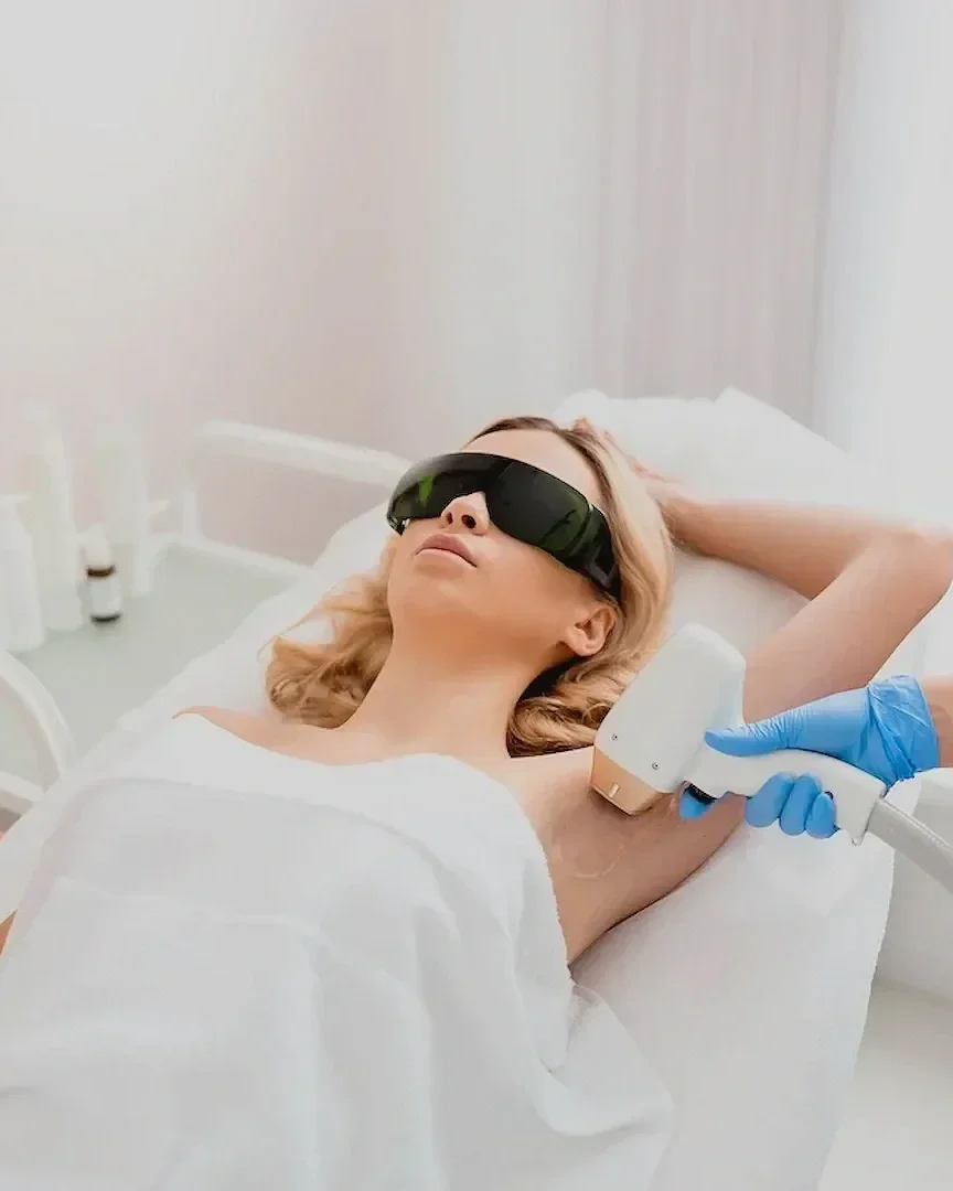 Triệt lông lạnh Diode Laser vùng nách tại Hugo Beauty Phú Nhuận TP HCM