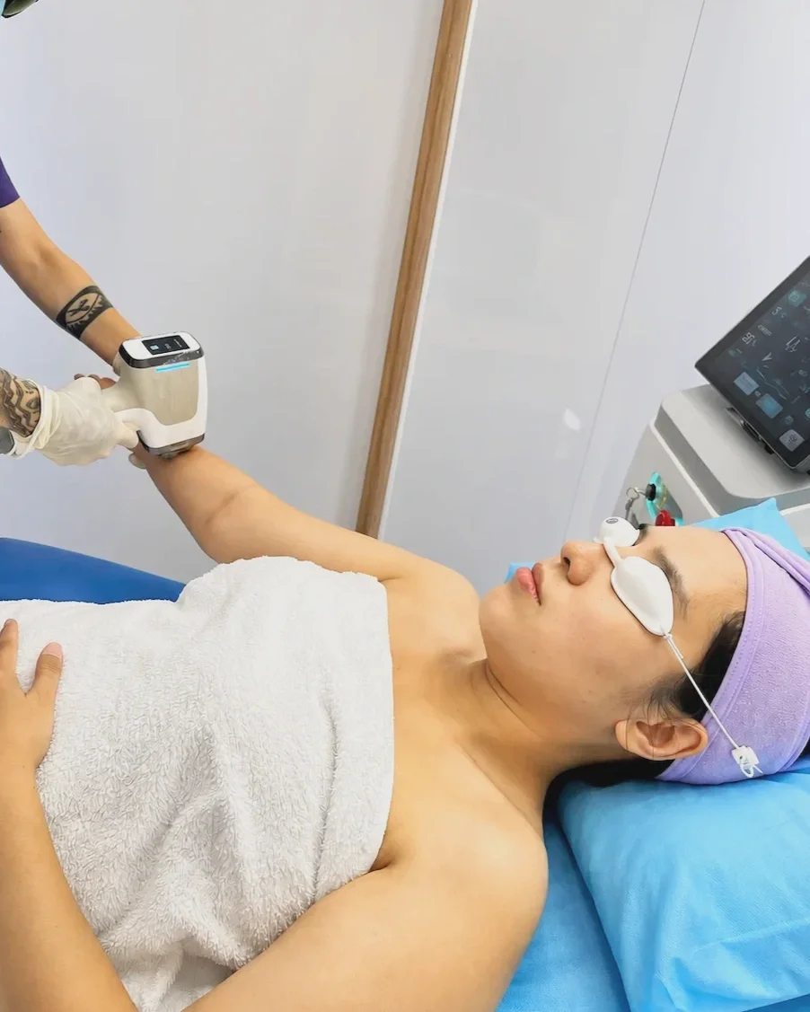 Khách hàng đang thực hiện triệt lông Diode Laser với công nghệ làm mát dịu nhẹ tại Hugo Beauty TP. Hồ Chí Minh