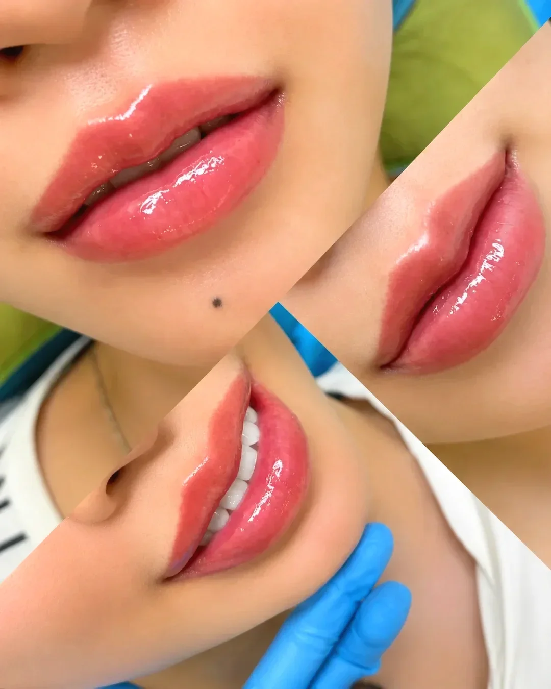 Đôi môi căng bóng nhẹ theo phong cách soft glam, giữ nguyên dáng tự nhiên tại Hugo Beauty, TP.HCM