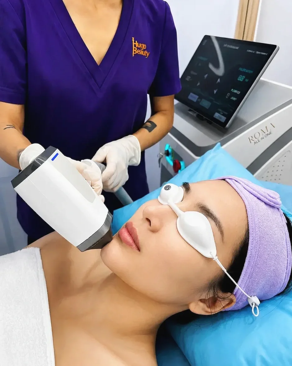 Khách hàng trải nghiệm triệt lông công nghệ lạnh trong không gian chăm sóc riêng tư tại Hugo Beauty Phú Nhuận