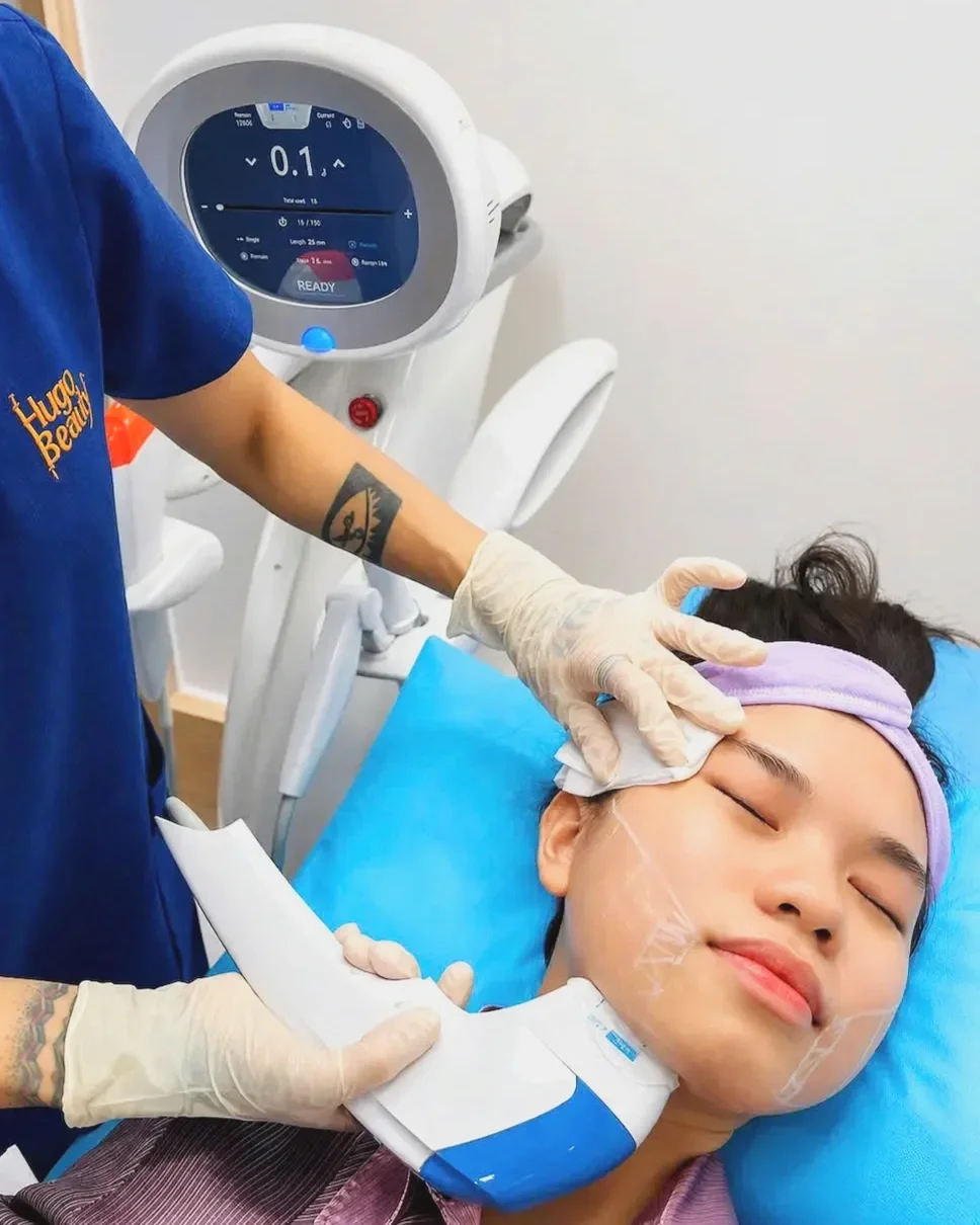 Nâng cơ HIFU 10D – công nghệ trẻ hóa da không xâm lấn, sử dụng sóng siêu âm hội tụ tác động sâu vào lớp SMAS, kích thích tăng sinh collagen và elastin, giúp da săn chắc, căng mịn và ngăn ngừa lão hóa hiệu quả.