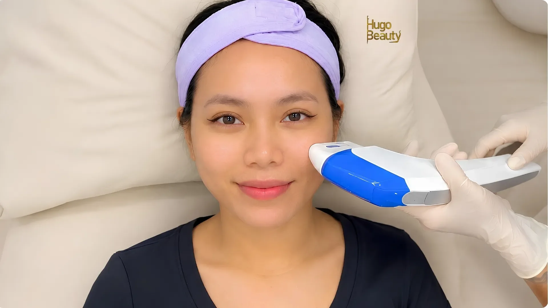 Công nghệ siêu âm hội tụ HIFU Ultraformer MPT tác động sâu dưới da hỗ trợ nâng cơ tự nhiên