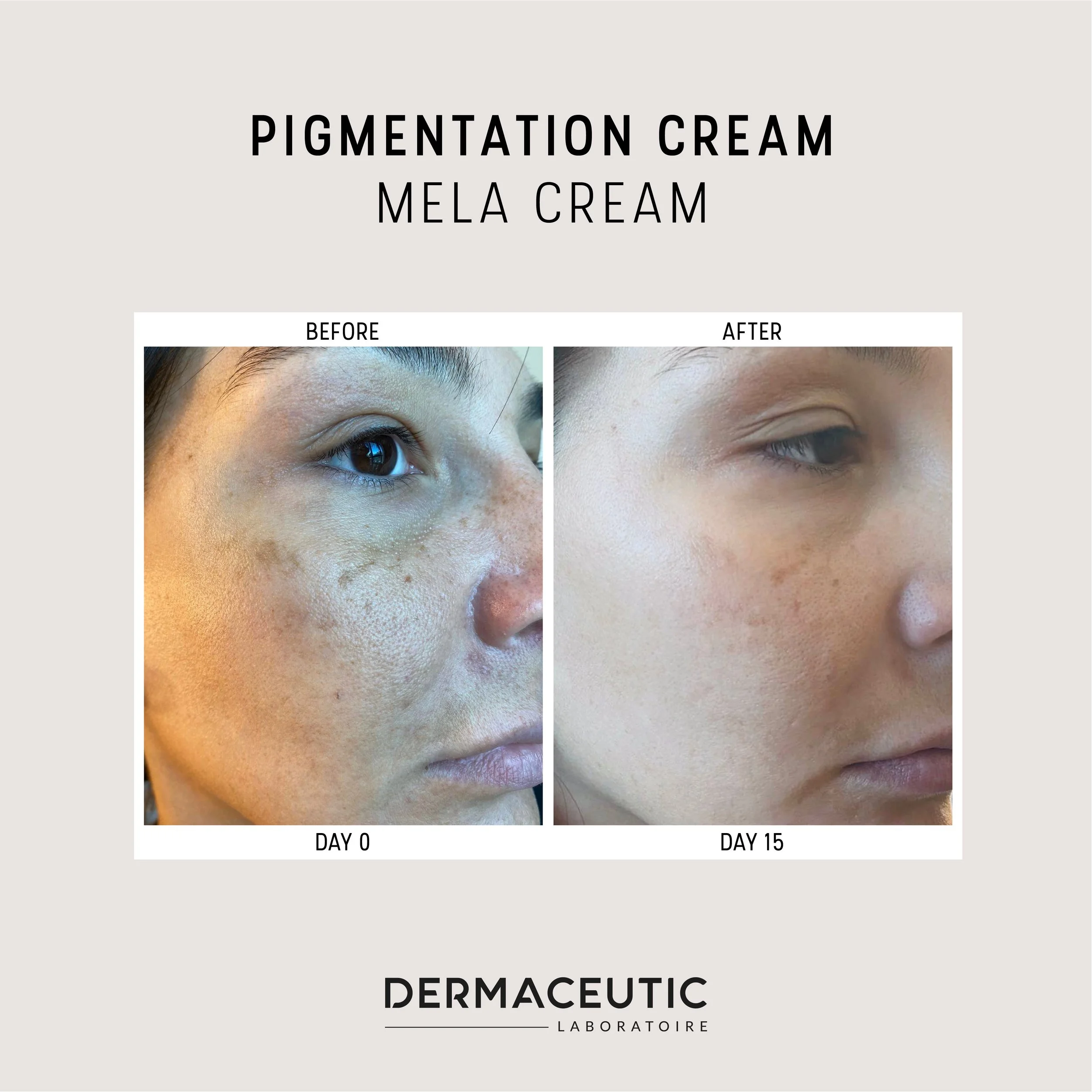 B&A Mela Cream 1 1080x1080px 1021.jpg