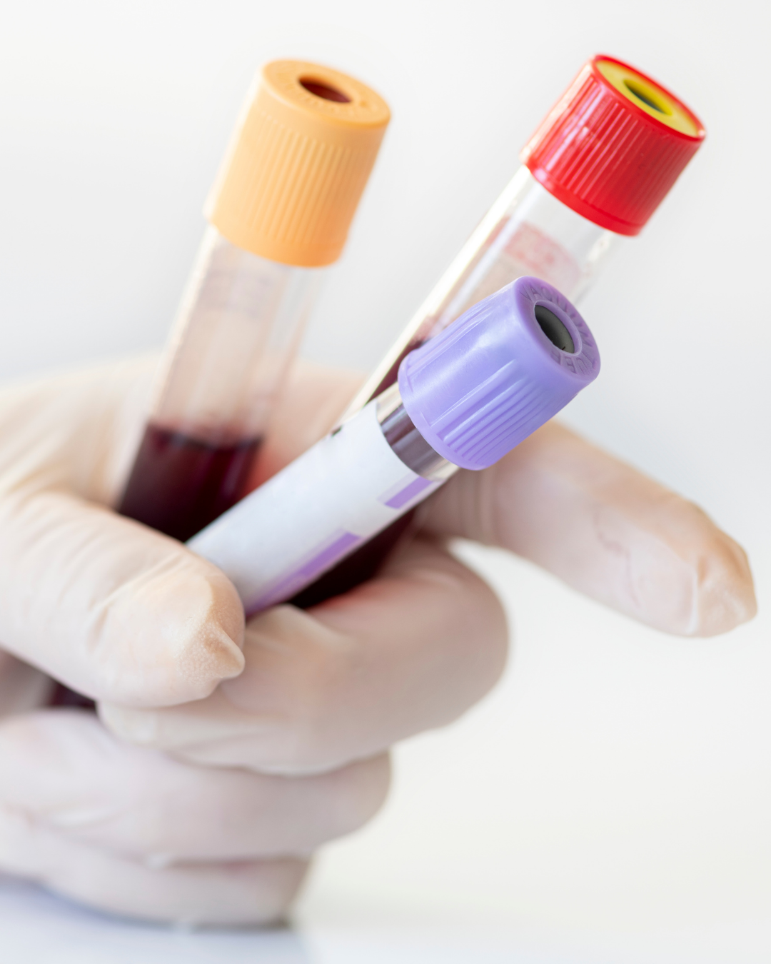 Why Most Doctors Don’t Run Comprehensive Lab Panels — And Why You Should