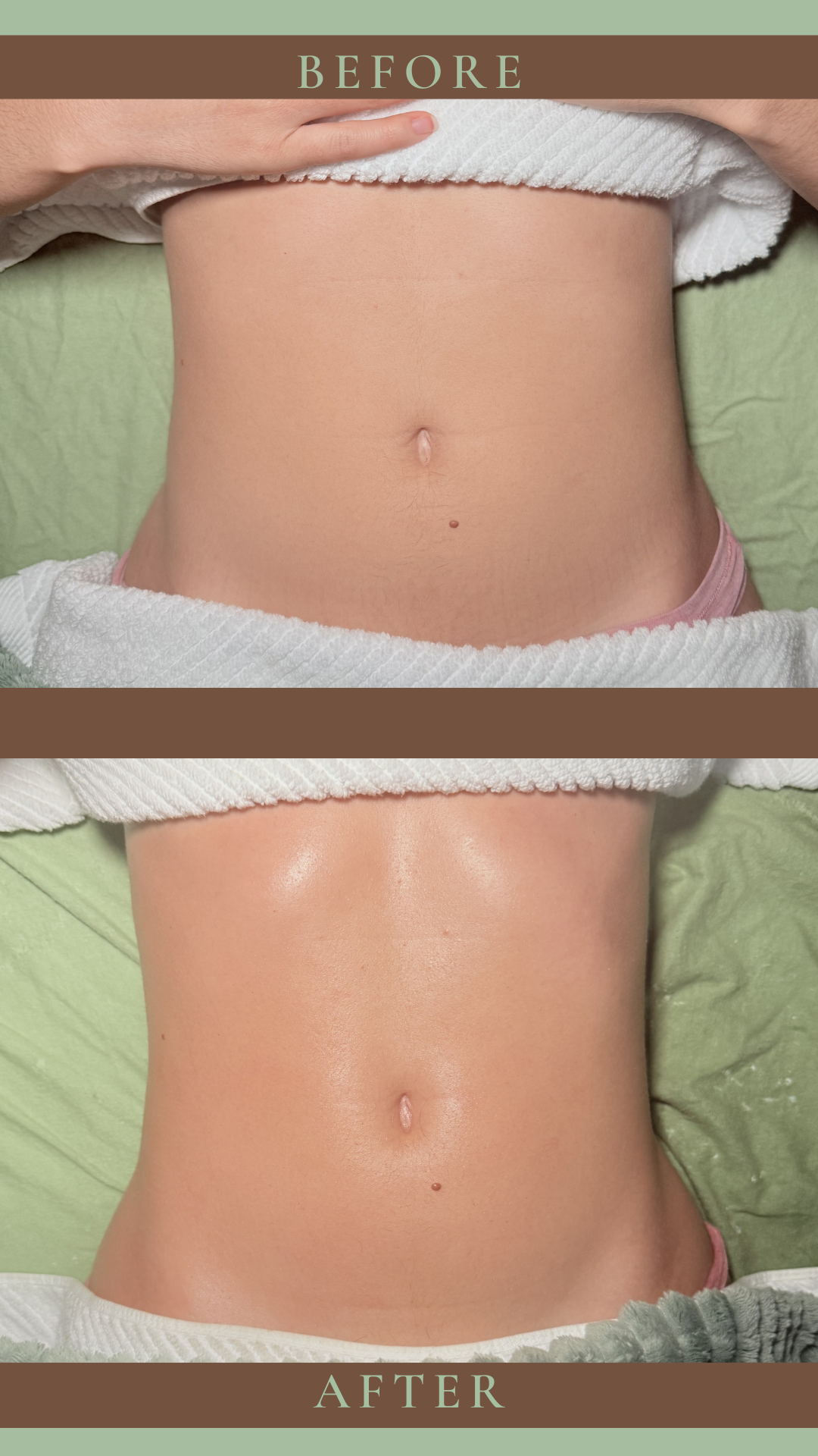 Copy of Before after 1 part  - 1.PNG