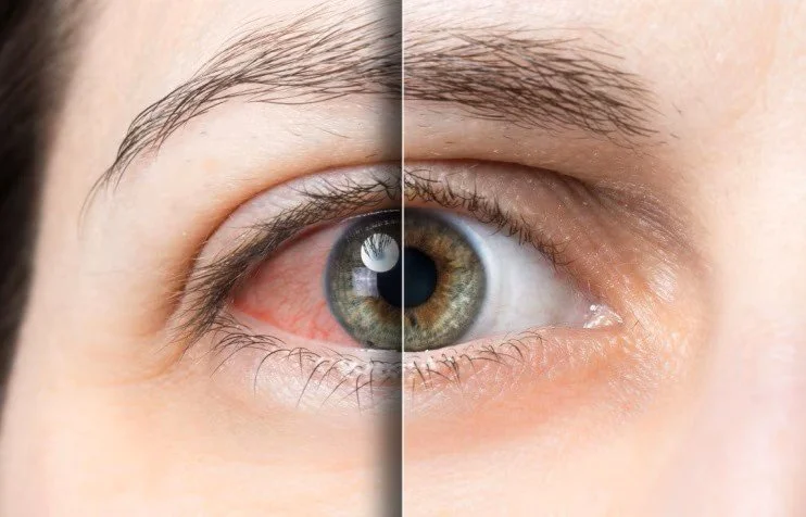How mood stabilizers & antipsychotics may affect eyes & vision (Jul 31, 2025)
