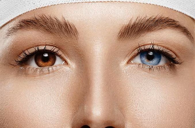 Is eye color change surgery safe? (Nov 19, 2025)