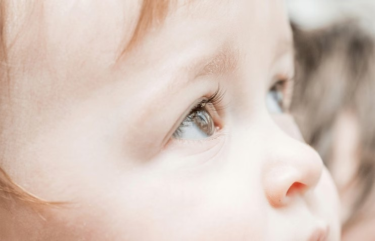 Buphthalmos | What it is & how it affects babies' eyes (Jun 16, 2025)