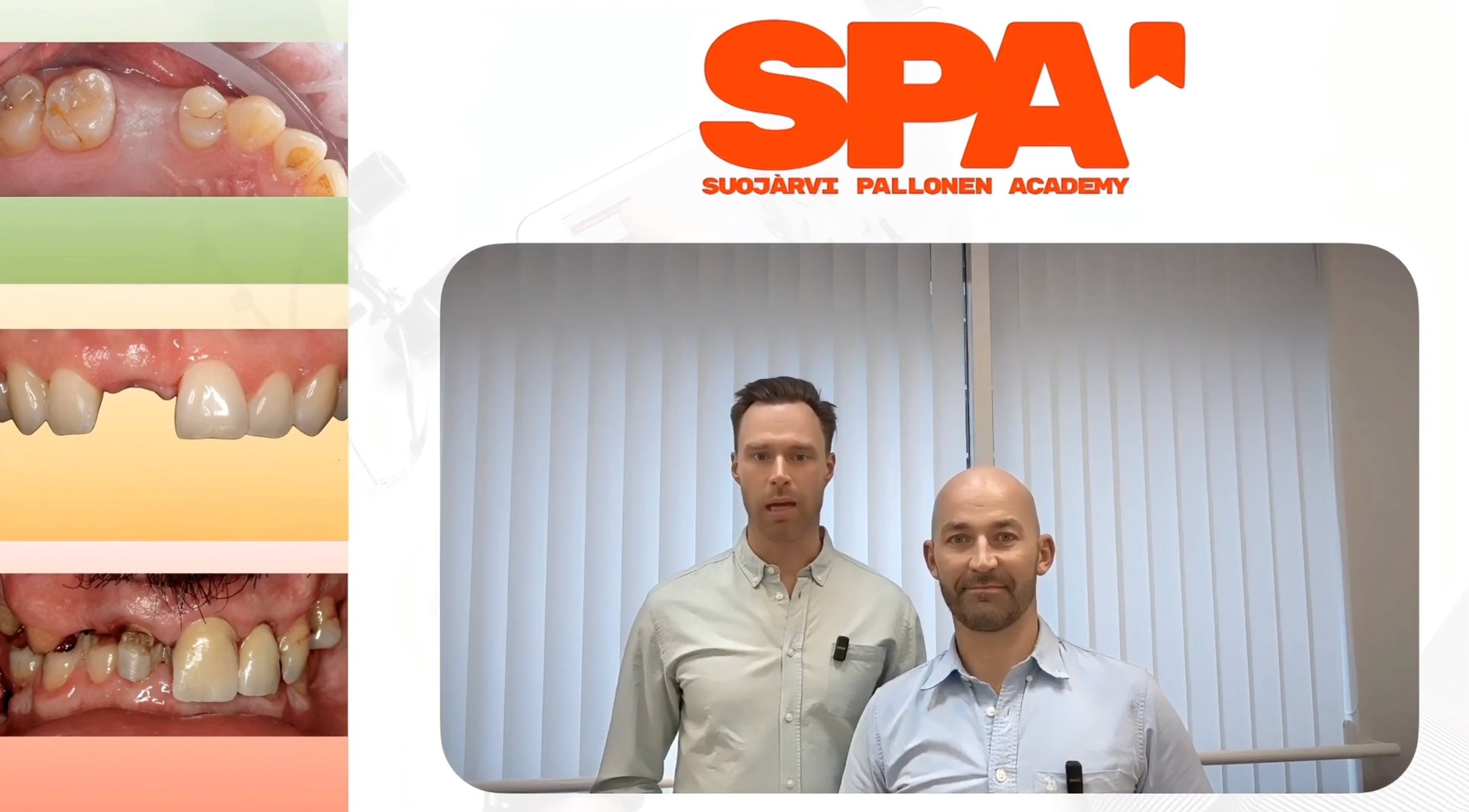 ITI Academy On-Demand: Treatment Planning – The SPA Way, Utilizing the SAC Tool in Clinical Practice