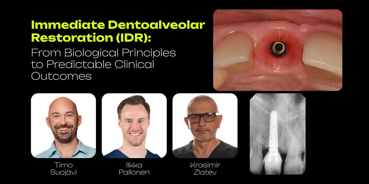 OHI-S On-Demand: Immediate Dentoalveolar Restoration (IDR): From Biological Principles to Predictable Clinical Outcomes